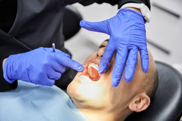 Best Emergency Dental Care for Sports Injuries in Parksdale, CA